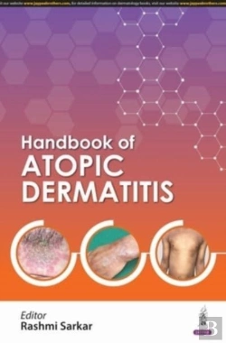 Bertrand.pt - Handbook Of Atopic Dermatitis