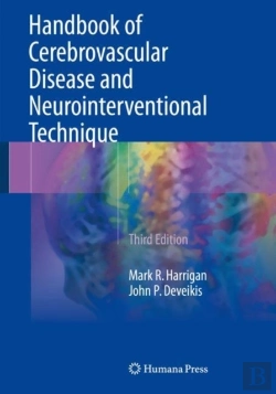 Bertrand.pt - Handbook Of Cerebrovascular Disease And Neurointerventional Technique