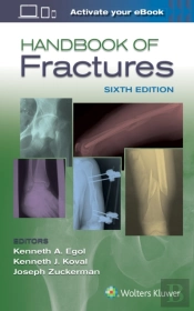 Handbook Of Fractures