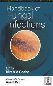 Handbook Of Fungal Infections