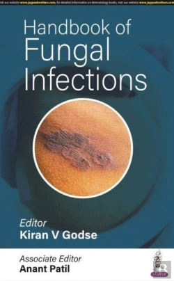 Bertrand.pt - Handbook Of Fungal Infections