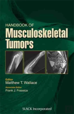 Bertrand.pt - Handbook Of Musculoskeletal Tumors