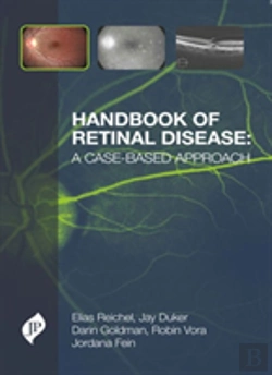 Bertrand.pt - Handbook Of Retinal Disease: A Case-Based Approach