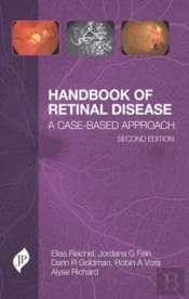 Handbook Of Retinal Disease