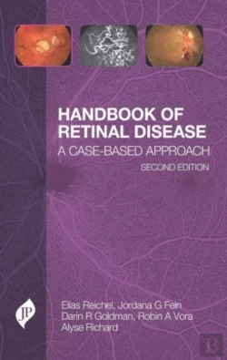 Bertrand.pt - Handbook Of Retinal Disease
