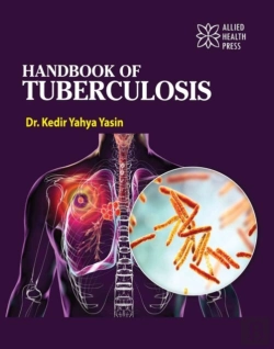 Bertrand.pt - Handbook Of Tuberculosis