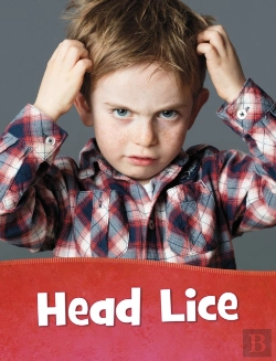 Bertrand.pt - Head Lice