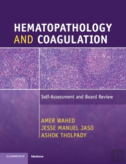 Bertrand.pt - Hematopathology And Coagulation