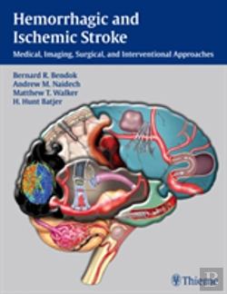 Bertrand.pt - Hemorrhagic And Ischemic Stroke