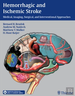 Bertrand.pt - Hemorrhagic And Ischemic Stroke
