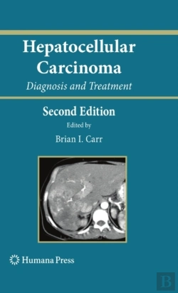 Bertrand.pt - Hepatocellular Carcinoma