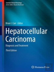 Hepatocellular Carcinoma
