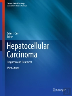 Bertrand.pt - Hepatocellular Carcinoma