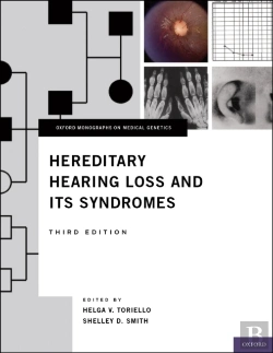 Bertrand.pt - Hereditary Hearing Loss And Its Syndromes