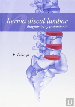 Bertrand.pt - Hernia Discal Lumbar