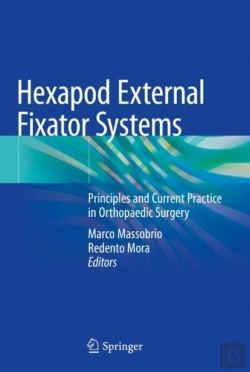 Bertrand.pt - Hexapod External Fixator Systems