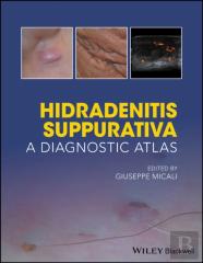 Hidradenitis Suppurativa: A Diagnostic Atlas