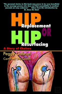 Bertrand.pt - Hip Replacement Or Hip Resurfacing: A Story Of Choices