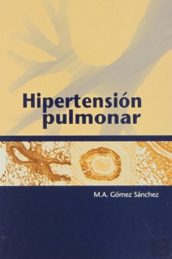Bertrand.pt - Hipertensión Pulmonar