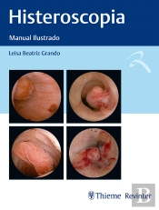 Histeroscopia
