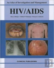 Hiv/Aids