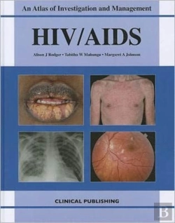 Bertrand.pt - Hiv/Aids