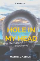 Hole In My Head