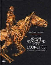 Honoré Fragonard Et Ses Écorchés ; Un Anatomiste Au Siècle Des Lumières