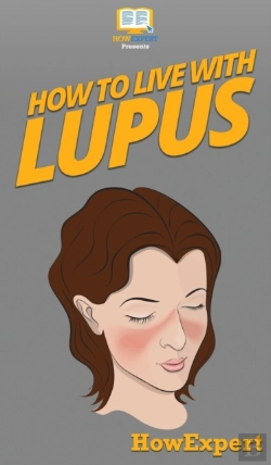 Bertrand.pt - How To Live With Lupus
