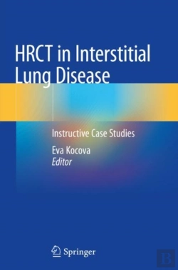 Bertrand.pt - Hrct In Interstitial Lung Disease