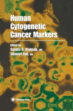Bertrand.pt - Human Cytogenetic Cancer Markers