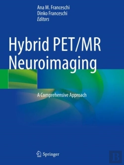 Bertrand.pt - Hybrid Pet/Mr Neuroimaging