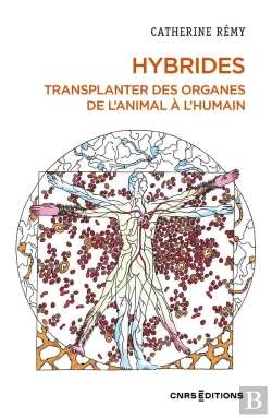 Bertrand.pt - Hybrides : Transplanter Des Organes De L'Animal À L'Humain