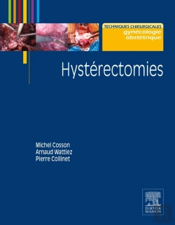Bertrand.pt - Hystérectomies