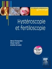Hystéroscopie Et Fertiloscopie