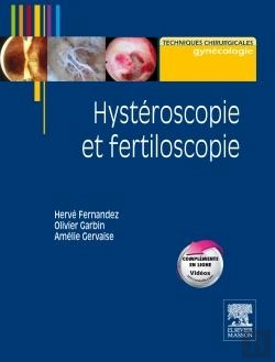 Bertrand.pt - Hystéroscopie Et Fertiloscopie