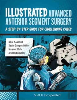Bertrand.pt - Illustrated Advanced Anterior Segment Surgery
