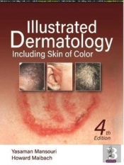 Illustrated Dermatology