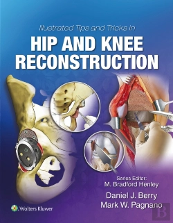 Bertrand.pt - Illustrated Tips And Tricks In Hip And Knee Reconstructive And Replacement Surgery