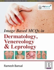 Image Based Mcqs In Dermatology, Venereology & Leprology
