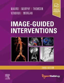 Bertrand.pt - Image-Guided Interventions
