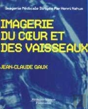 Imagerie Coeur