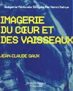 Bertrand.pt - Imagerie Coeur