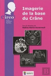 Imagerie De La Base Du Crâne