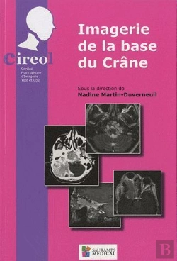Bertrand.pt - Imagerie De La Base Du Crâne