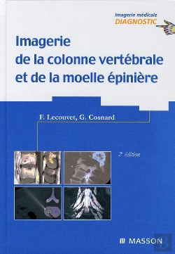 Bertrand.pt - Imagerie De La Colonne Vertébrale, Moëlle Épinière