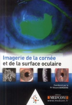 Bertrand.pt - Imagerie De La Cornee Et De La Surface Oculaire