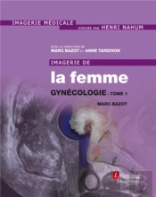 Imagerie De La Femme : Gynécologie