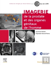 Imagerie De La Prostate Et Des Organes Génitaux De L'Homme