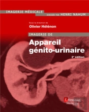 Imagerie De L'Appareil Génito-Urinaire (2e Édition)